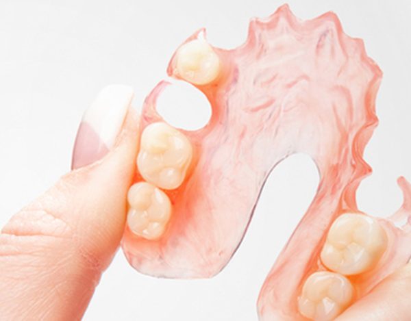 Custom dental appliance crafted by Whitworth Dental Lab.